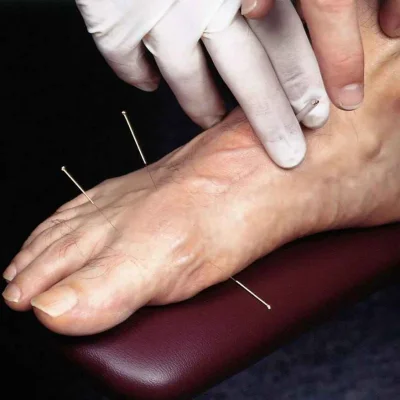 Услуга - https://osteopat-nevrolog.ru/uslugi-pacientam/6-igloukalyvanie-posle-insulta.html