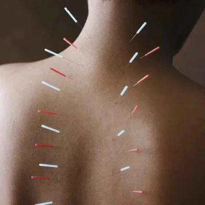 Услуга - https://osteopat-nevrolog.ru/uslugi-pacientam/8-igloukalyvanie.html